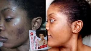 White Secret Whitening face Cream