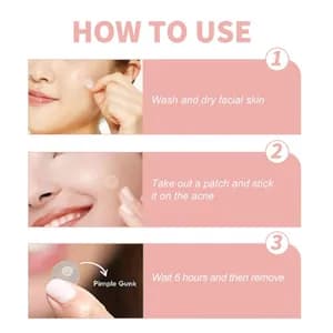 Hydrocolloid Acne Patch 144 Pcs