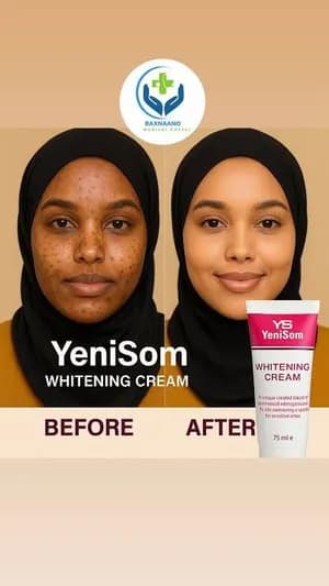 YeniSom Lightening Cream