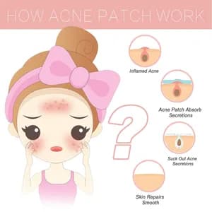 Hydrocolloid Acne Patch 144 Pcs